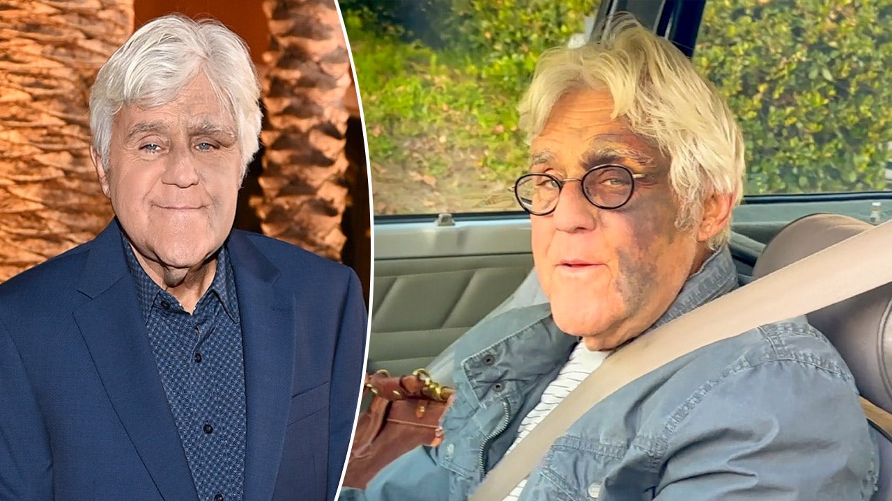 Jay Leno puts mob beating rumors to rest regarding facial bruises