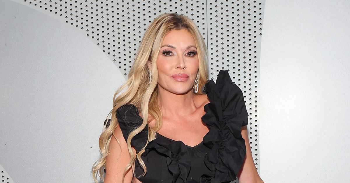 Everything Brandi Glanville Has Said About Her Facial Disfigurement