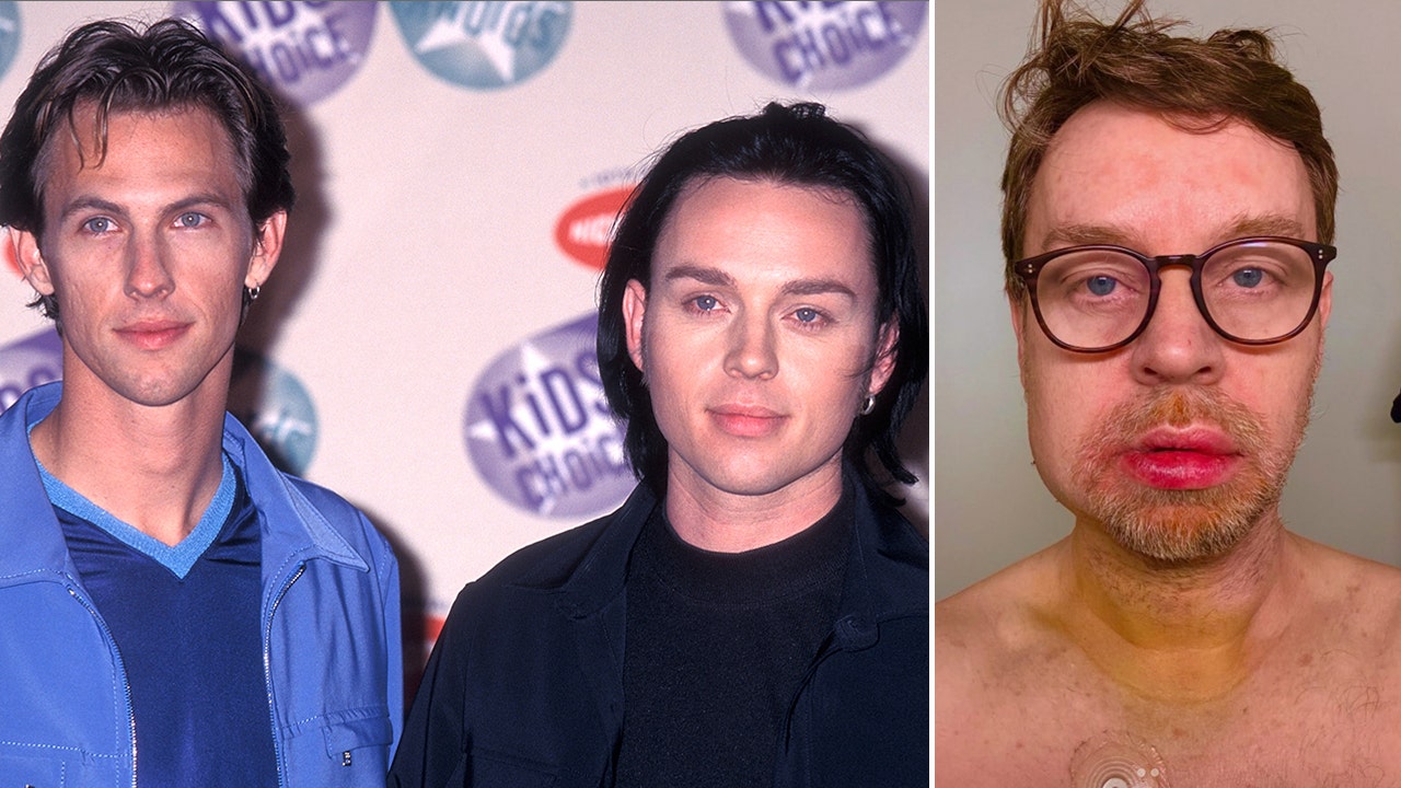 Darren Hayes of Savage Garden had ‘terrible accident’ leading to broken jaw
