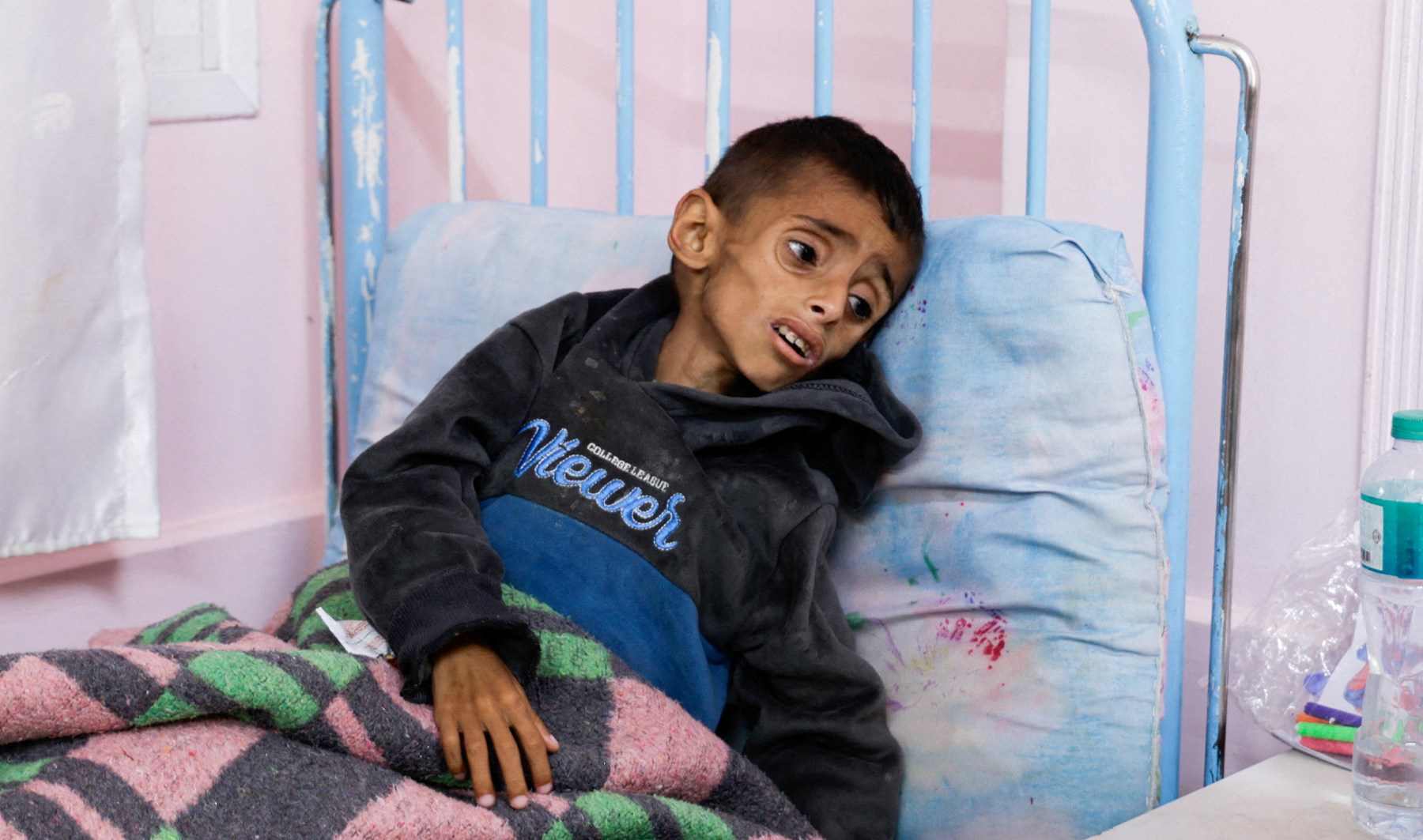 Gaza mother pleads for help to save emaciated 5-year-old